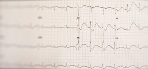Image for What is Hypokalemia?
