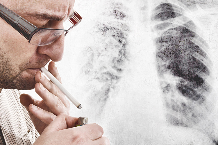 A man smoking whilst a lung disease is shown in the background.