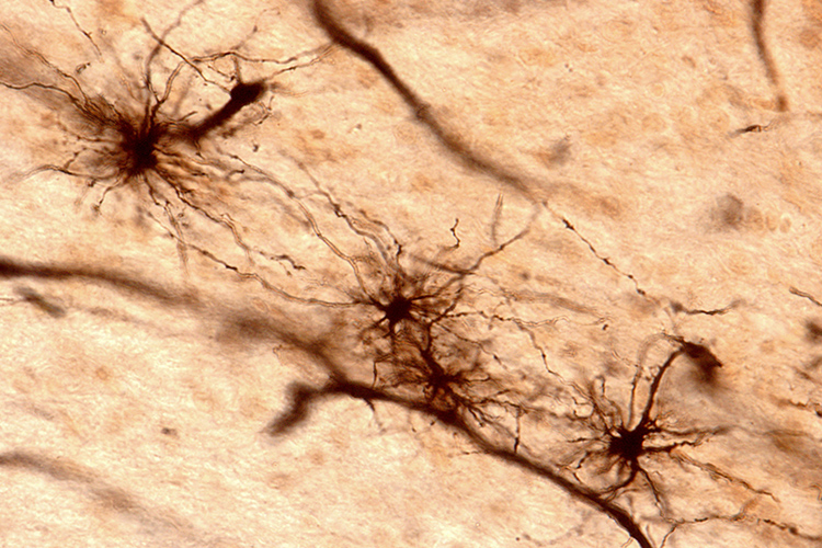 ibrous astrocytes of brain tissue