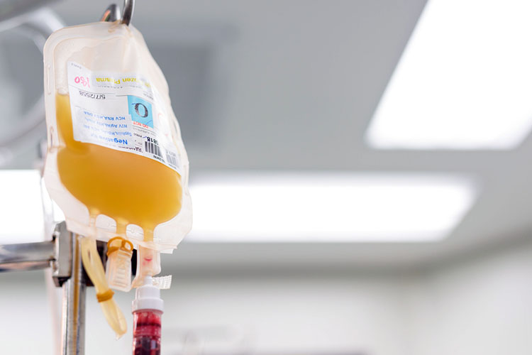 massive blood transfusion fresh frozen plasma