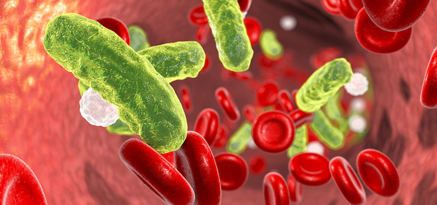 Cover image for article: What Is Sepsis? – Clinical Guidelines for Nurses