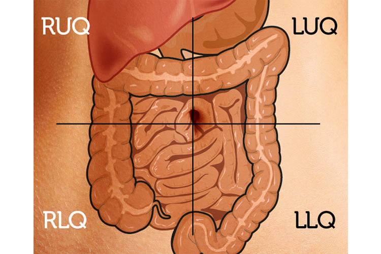 hyperactive bowel sounds intervals