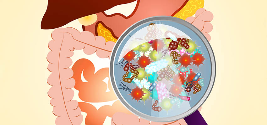 Cover image for article: Human Gut Microbiome – 10 Considerations