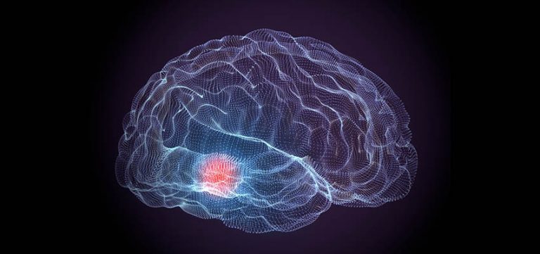 Image for Parkinson’s Disease