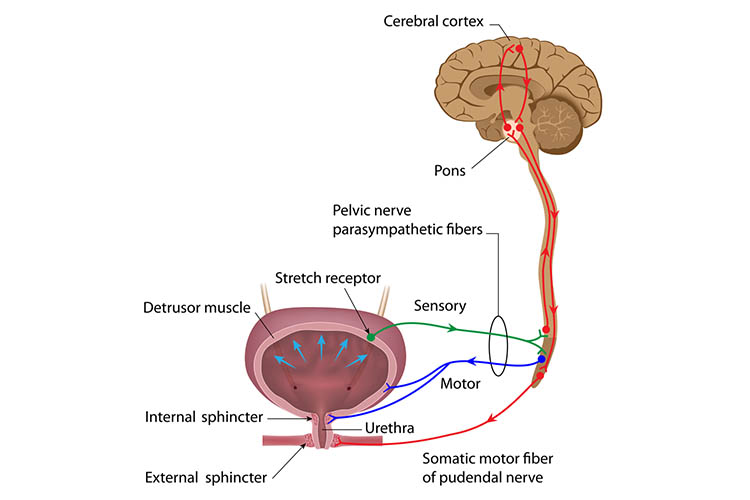 overflow incontinence neurogenic