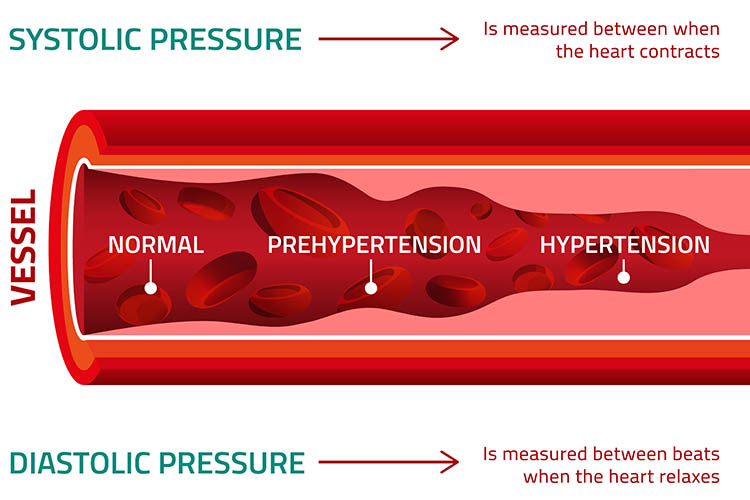 systolic v diastolic blood pressure