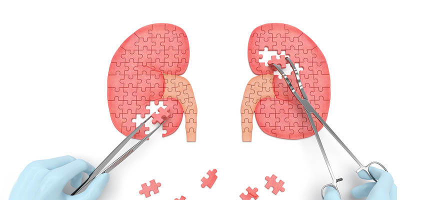 Cover image for article: What Do You Know About Kidney Health?