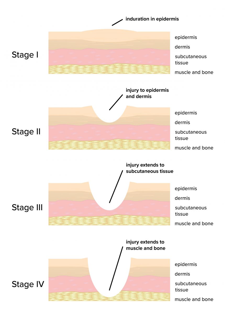 Scar Wound Edges at Wiley blog