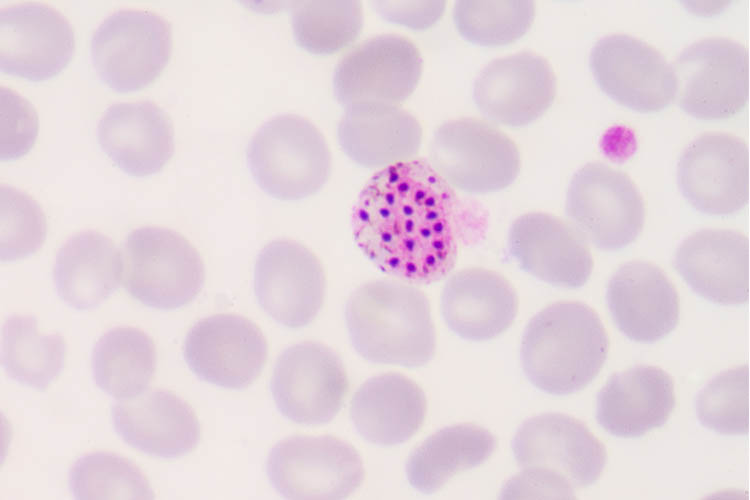 Malaria: Why Should Australians Worry About Malaria? - Ausmed microscopic