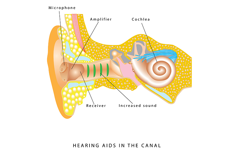 ageing and hearing loss diagram