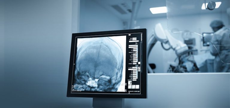 Image for Hydrocephalus and Shunts