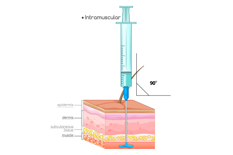 muscle injection