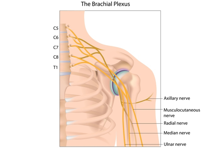 brachial plexus diagram