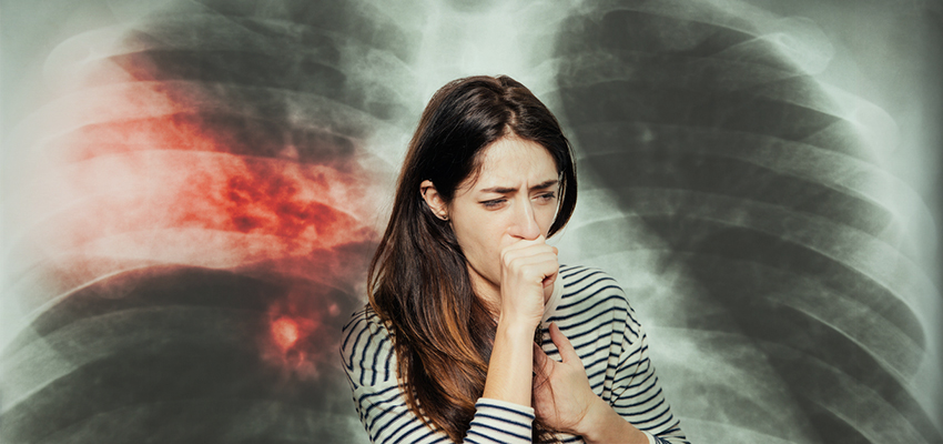 Cover image for article: Pneumonia Symptoms, Signs and Treatment
