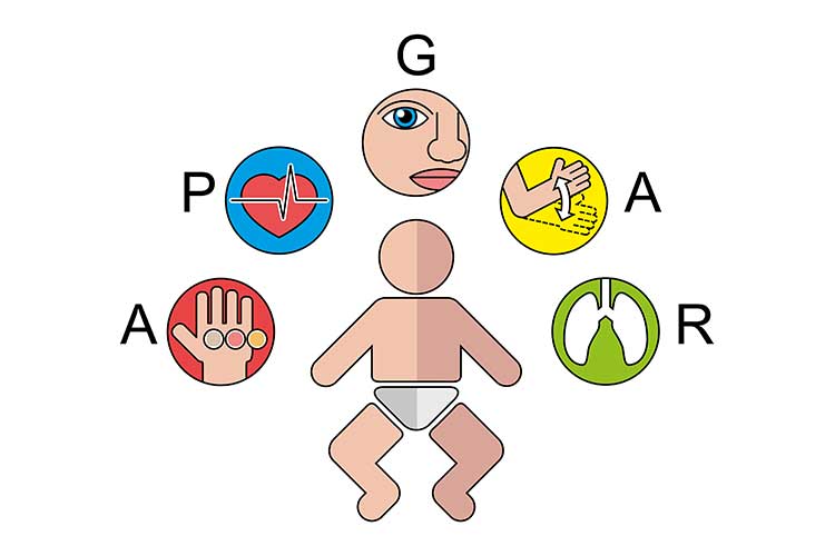 Examination of the Newborn: The First 72 Hours of Life APGAR concept