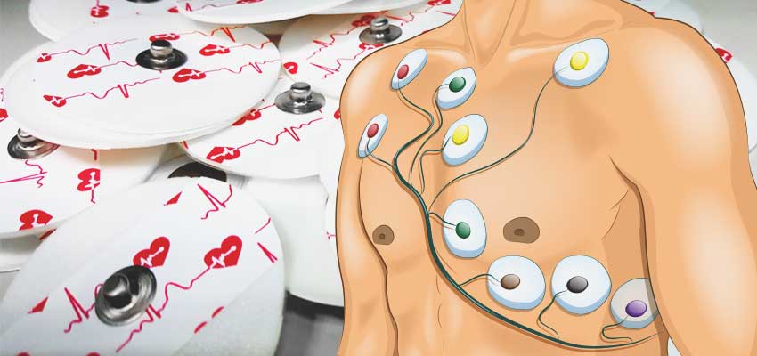 Cover image for article: 12 Lead ECG Placement