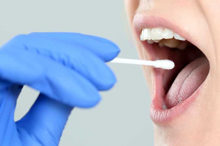 saliva mouth swab