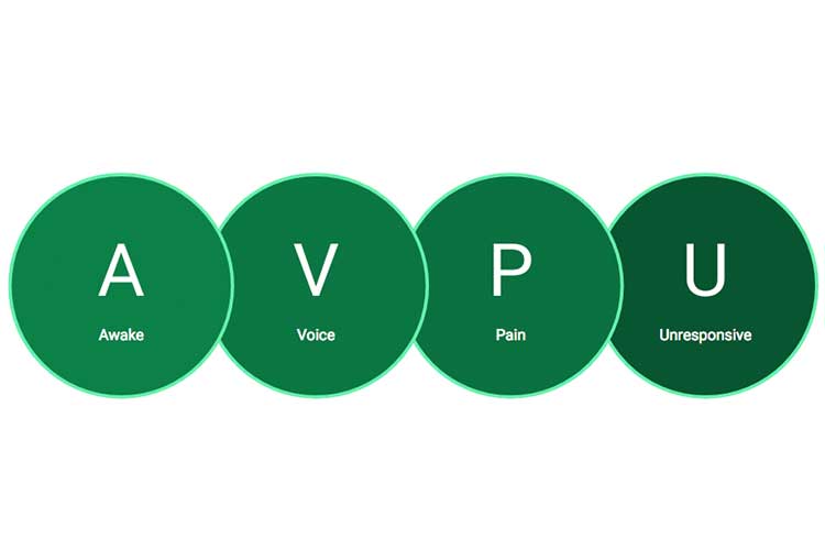 AVPU Neurological assessment ABCDE Assessment - How To Assess a Critically Ill Patient | Ausmed