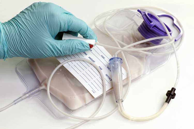 Nurse inspecting an enteral feeding pump bag