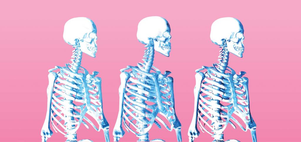 Cover image for article: Osteogenesis Imperfecta – Fragile Bones